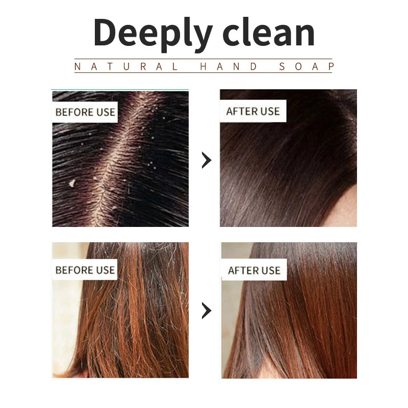 Tea Tree Shampoo